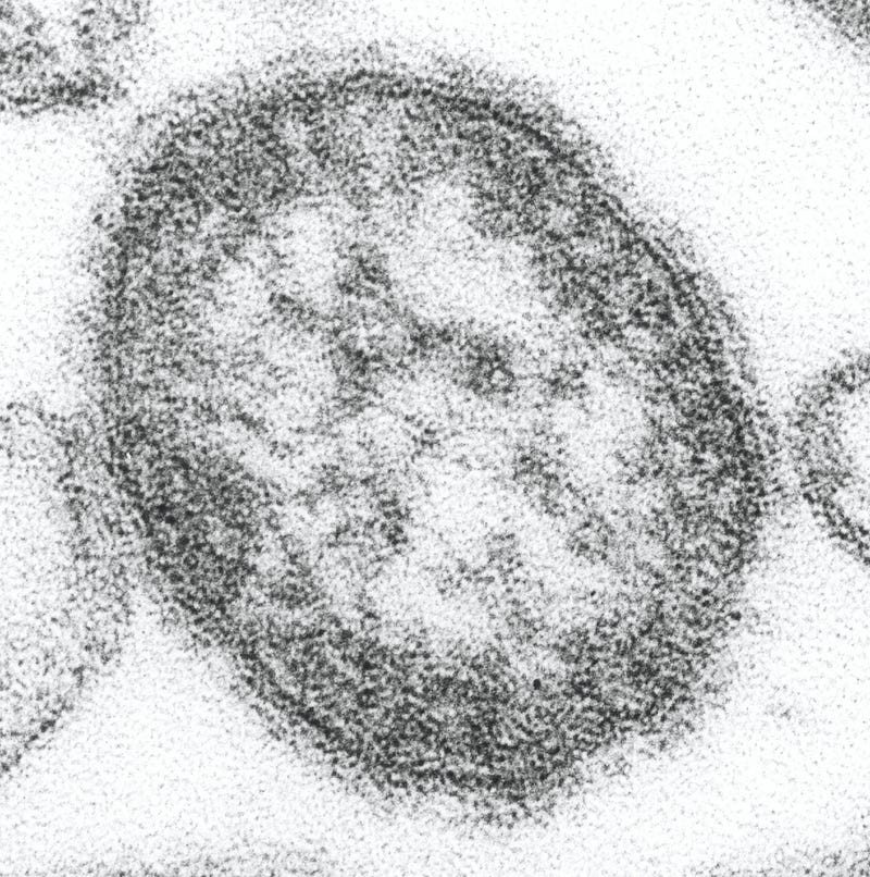 Electron microscope image of the measles virus