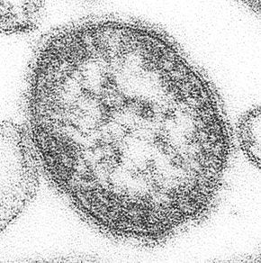 Electron microscope image of the measles virus