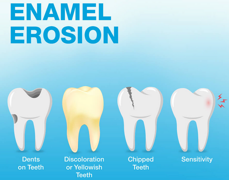 The impact of diet on dental health