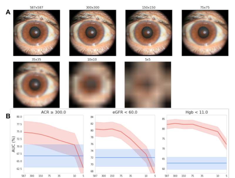 Impact of image resolution on model performance.