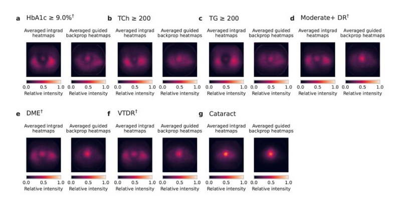 Saliency map illustrating predictive focus areas.