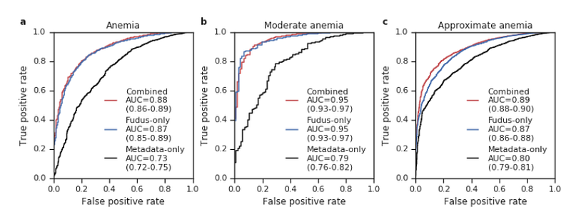 Anemia classification predictions via deep learning.